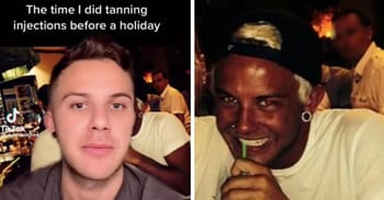 Doctors Label Man An Idiot After A Bizarre Tanning Injection Disaster