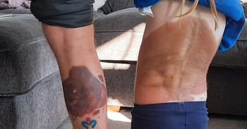 Dad Gets Tattoo Of Daughter's Large Birthmark