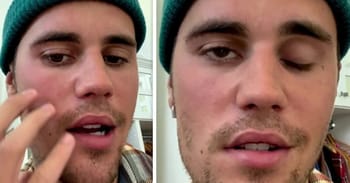 Justin Bieber Reveals He Has Suffered Facial Paralysis From Ramsay Hunt Syndrome