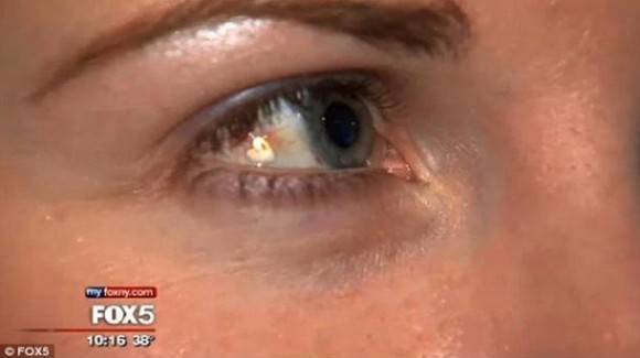 The world is losing its mind. Woman Has Heart-Shaped Twinkle Surgically Implanted on Her Eyeball