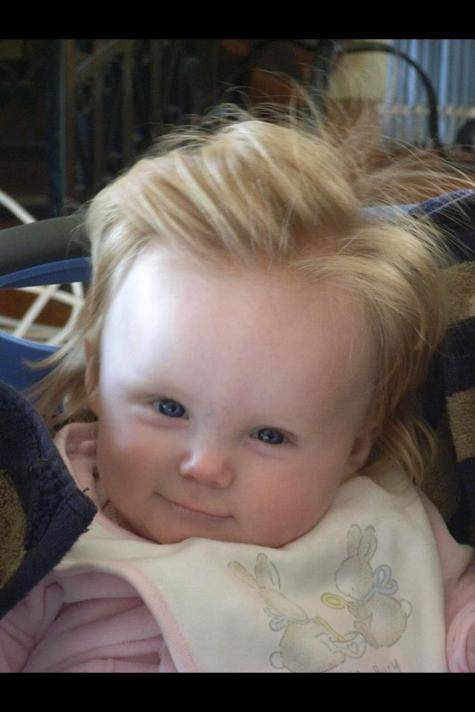 My friends baby was born with Conan hair!