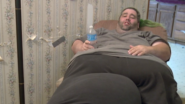Guy Has 80lb Mass Removed From Scrotum After Doctors Said He Just Needed To Lose Weight