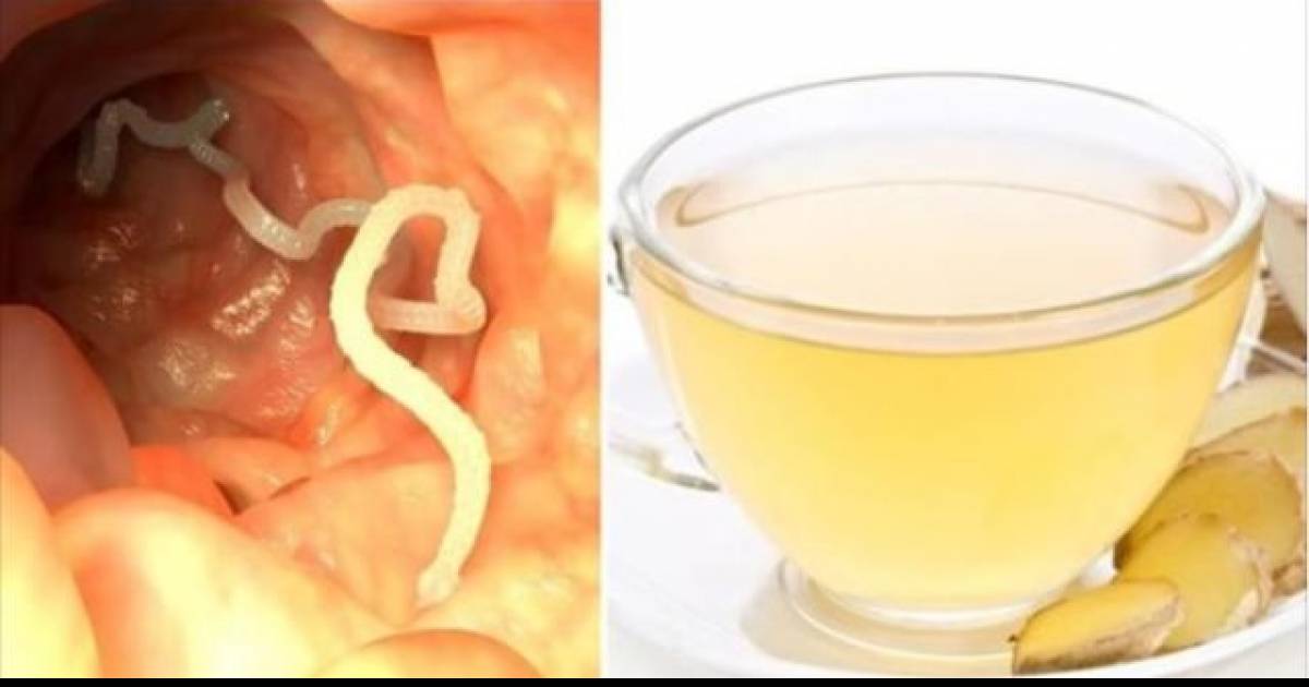 Garlic Is An Amazing Natural Remedy That Will Purge Parasites From Your
