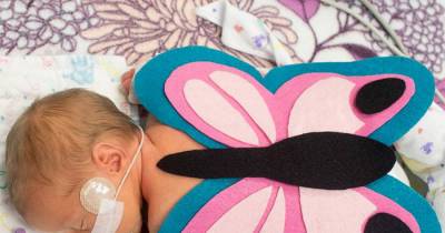 NICU Babies Get Tiny Halloween Costumes, & The Results Are Precious