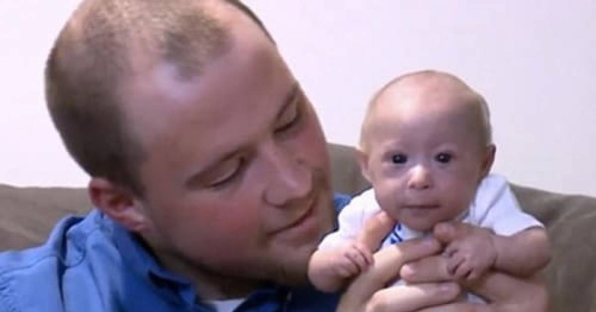 This 3-Pound Baby Was Born With A Rare Growth Disorder That Makes Him