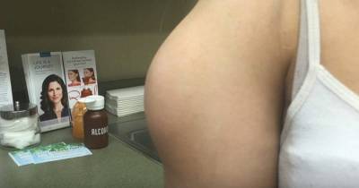 New Dr. Pimple Popper Video Shows Off Her Biggest Pop Yet