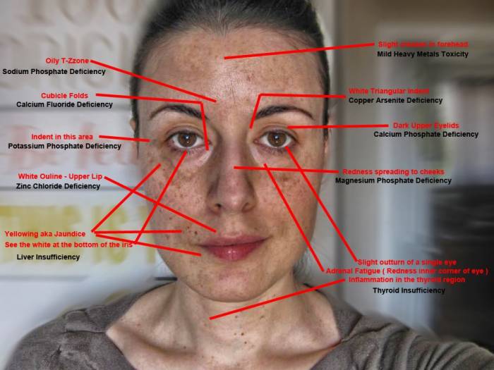 Signs Your Body Is Full Of Toxic Heavy Metals And How To Detoxify