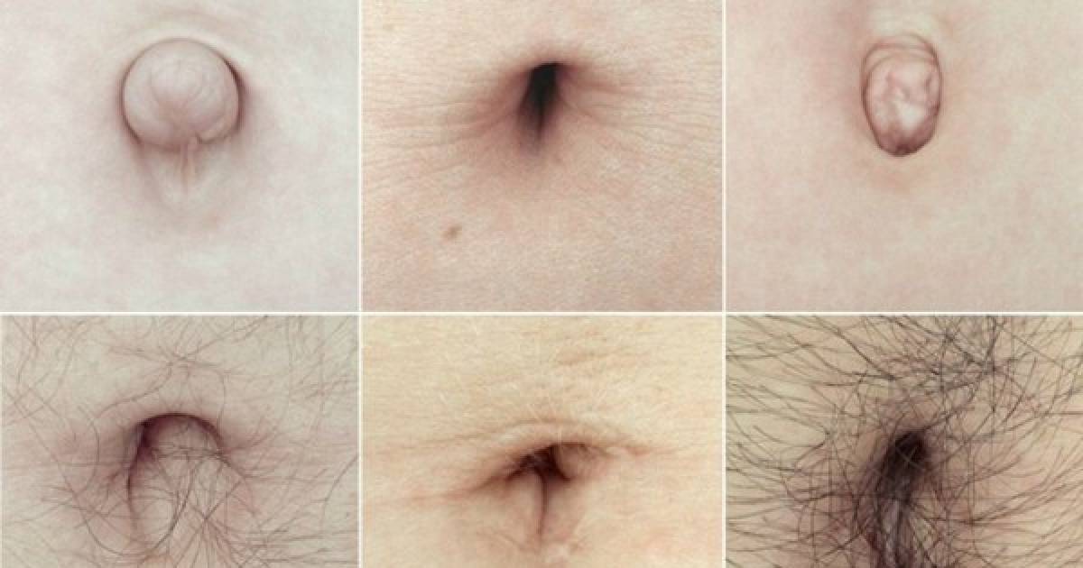 The Shape Of Your Belly Button Can Reveal A Lot About Your Personality
