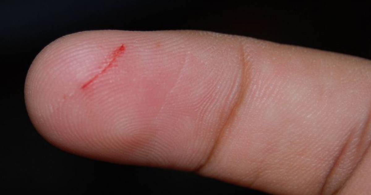 A Doctor Finally Tells Us The Reason Why Paper Cuts Hurt So Much?