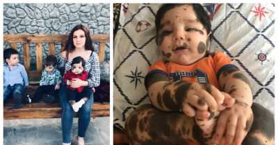 Parents of baby with 'Birthmarks On 80% of The Body' were advised to leave him at the hospital if they didn't want him, they declined and said it's a 'gift from God'