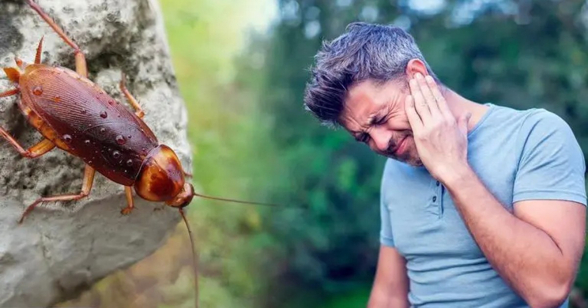 Man's 'Blocked Ear' Turns Out To Be Huge Cockroach Hidden Inside