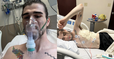 22-Year-Old Says Vaping Addiction Caused His Lungs To Collapse