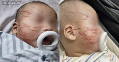 Mom Horrified After Picking Baby Up From Daycare To Find His Face Covered In Scratches