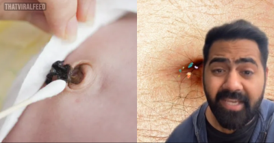 Doctor Reveals Grim Reality Of What Happens When You Don't Wash Your Belly Button