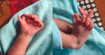 Baby Born With 26 Fingers And Toes Hailed As ‘Second Coming Of Hindu Goddess’