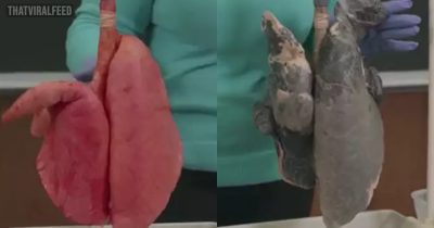Horrifying Video Shows Difference Between Smokers And Non-Smokers Lungs