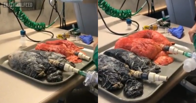Terrifying Video Shows Shocking Difference Between Breathing Of A Healthy And A Smoker's Lung