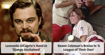 14 Times Actors' Real-World Injuries Were Written Into Movies