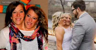 Conjoined Twins Hit Out At The 'Haters' In New Post After Revealing Abby Hensel Got Married
