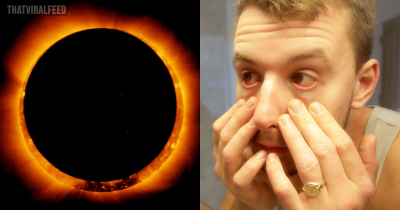 Google Searches For 'Why Do My Eyes Hurt' Skyrocketed Immediately After The Solar Eclipse