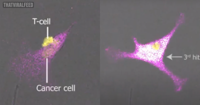 People Amazed At 'Wild' Video Of Immune Cell Fighting A Highly Aggressive Deadly Cancer Cell And Winning