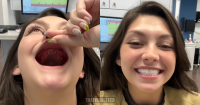 Woman Shares Her Incredible Journey Of Getting 'New Teeth' That's Leaving People In Tears