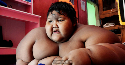 Former 'World's Fattest Boy' Is Completely Unrecognizable After Losing Half His Weight