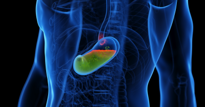 Gut Doctor Warns About 'Ticking Time Bomb' Cancer Risk That Many Don't Know They Have