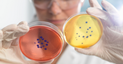 Scientists Raise Alarms Over 'Mirror Life' Bacteria That Could Wipe Out Life On Earth