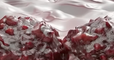 Frightening Animation Shows How Cancer Really Develops In The Body And Viewers Are Shaken