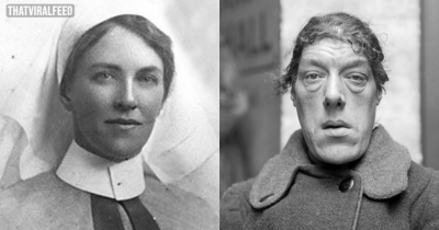 The Heartbreaking Life Of Mary Ann Bevan, The 'Ugliest Woman In The World'