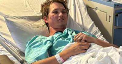 Man Attacked By Hyenas While Asleep At Bachelor Party Survived Thanks To Two Quick Actions