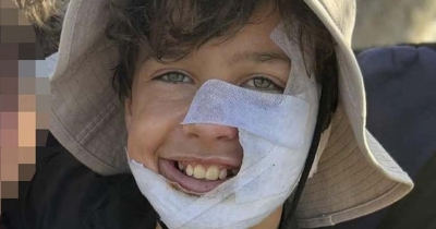 12-Year-Old Soccer Player Suffers Severe Burns After Park Prank Goes Horribly Wrong