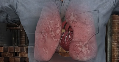 Simulation Reveals How Weed Impacts Your Body As Ex-User Explains Life After Quitting