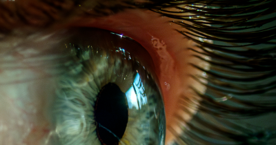 Expert Reveals How To Spot A Narcissist Just By Looking At Them