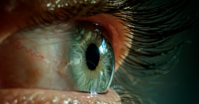 Eye Specialist Explains What To Do If You Start Seeing 'Floaters' Drifting Across Your Vision
