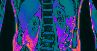 How Long Does It Take For Lungs To Heal From Vaping, And Exactly When Does It Cause Permanent Damage